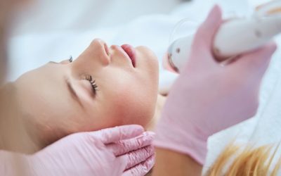 What is Secret RF Microneedling?