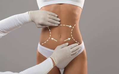 The Ultimate Guide to Body Contouring: What You Need to Know Before Your Miami Procedure