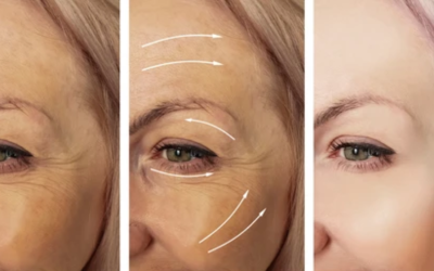 Sculptra Revelations: Journeying into the Heart of Youthful Transformation