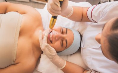 Secret RF vs. Morpheus8 Lavish Laser Helps You Choose the Right Treatment