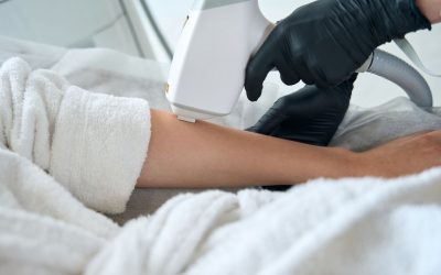Best Laser Hair Removal Options in Miami – Top Treatments at Lavish Laser Medspa