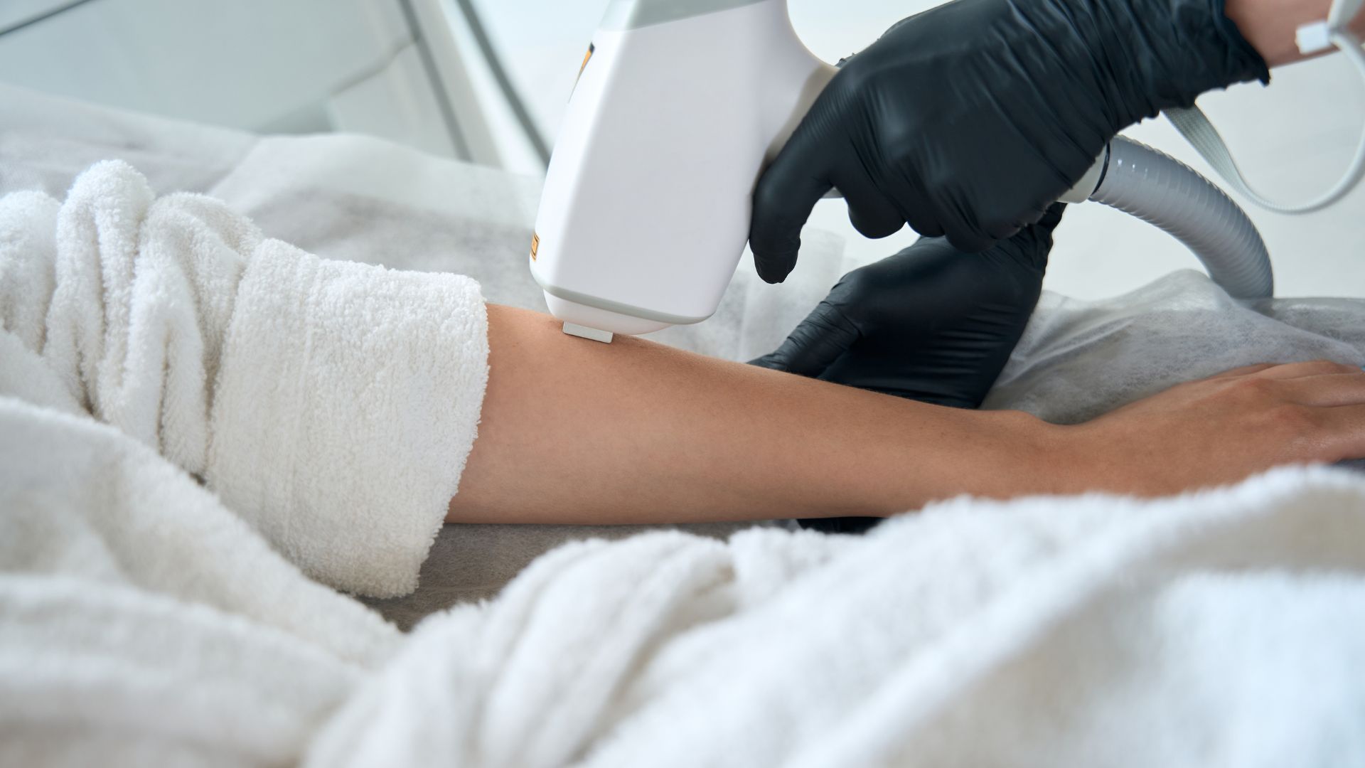 Best Laser Hair Removal Options in Miami – Top Treatments at Lavish Laser Medspa1