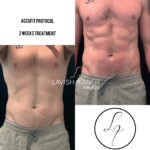 accufit before and after